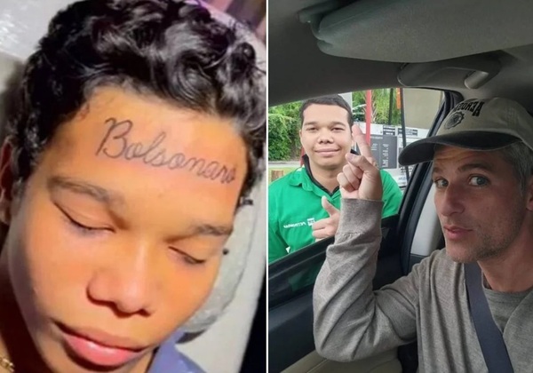 Jovem remove tatuagem de Bolsonaro da testa e tira foto com famoso apoiador de Lula