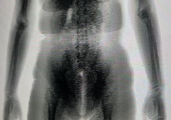 Mulher é flagrada por body scan ao tentar entrar com drogas em presídio na Bahia