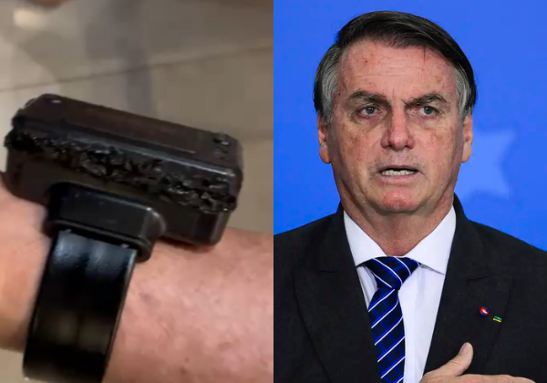 Laudo da PF confirma que Bolsonaro tentou abrir tornozeleira com objeto aquecido