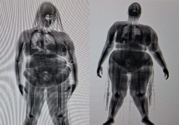 Mulheres são detidas ao tentar levar drogas a presídio na Mata Escura; Bahia soma 6º caso em 1 mês