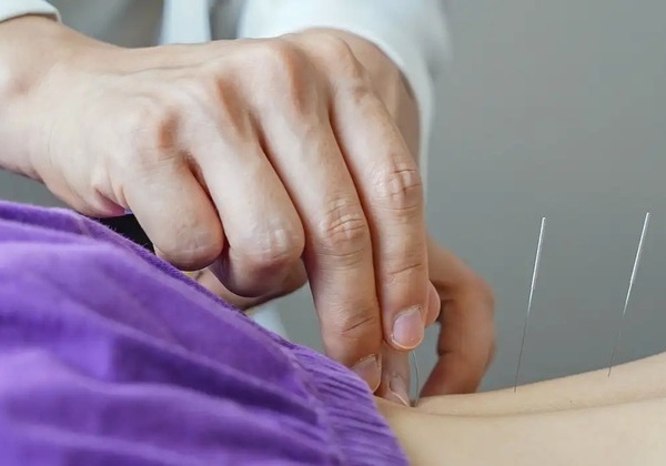 Brasil regulamenta exercício profissional da acupuntura