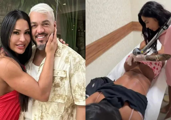 Gracyanne Barbosa inicia remoção de tatuagem íntima em homenagem a Belo