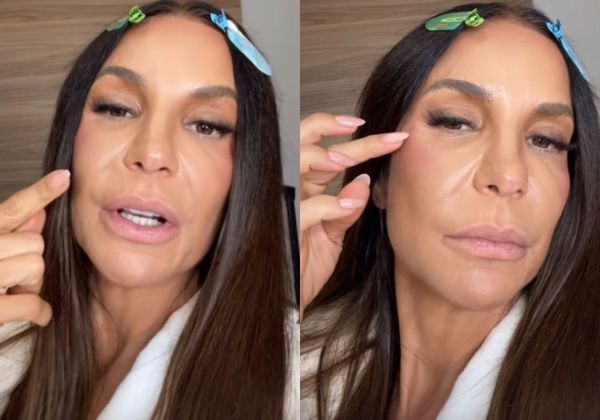 Ivete Sangalo atualiza fãs sobre recuperação após cirurgia e mantém foco na música 