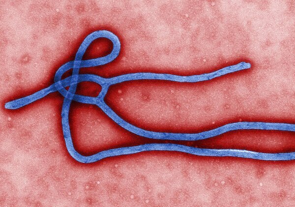 África tem 139 mortes suspeitas em surtos de ebola, diz OMS