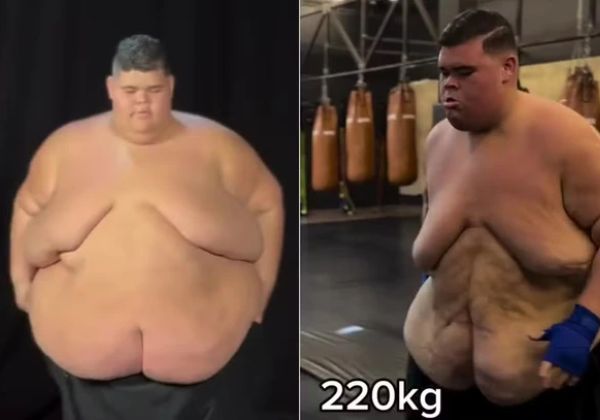 Após perder 130 kg, Gordão da XJ ainda precisa de ajuda da noiva para tomar banho  