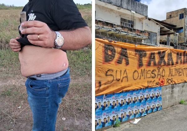 Candidato ao Governo da Bahia é atingido por bala de borracha durante manifestação em Salvador