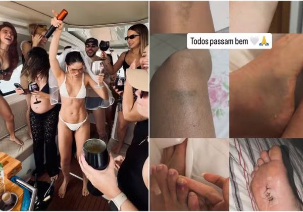 Juliette exibe hematomas após despedida de solteira: ‘Confundiram com o fim do mundo’ 