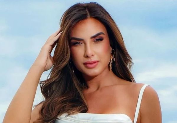 Nicole Bahls revela alopecia e cita Anitta como inspiração para falar sobre o diagnóstico 